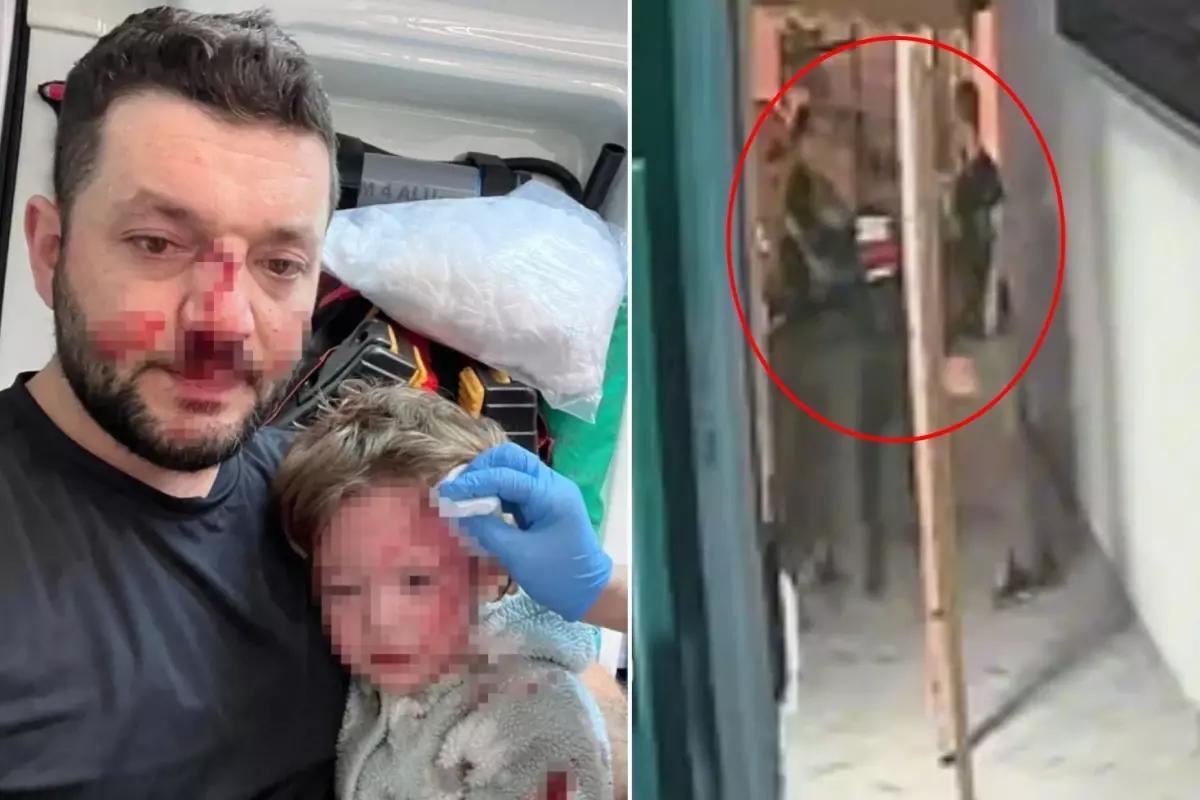 Yalova’da 14 Aylık Kız ve Babası Komşuları Tarafından Şiddet Görürken Görüntülendi