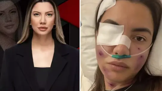 Yapay Zeka Destekli Sahte Görsel, Fulya Öztürk’ü Trafik Kazası İddialarından Temizledi