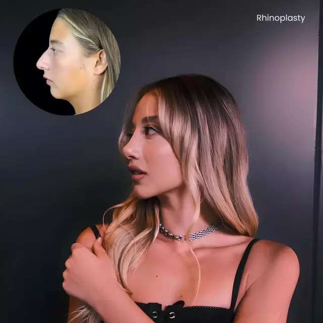 Aleyna Kalaycıoğlu'nun estetik sonrası fotoğrafı