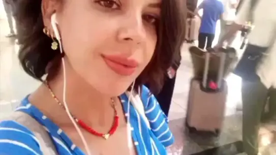 Beylikdüzü'nde Yüz Germe Ameliyatı Sonrası Ölüm İddiası Gündemde