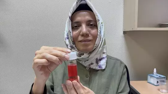 Süleyman Demirel Üniversitesi Göz Bankası, İki Yılda 100'ün Üzeri Kornea Nakli Gerçekleştirdi