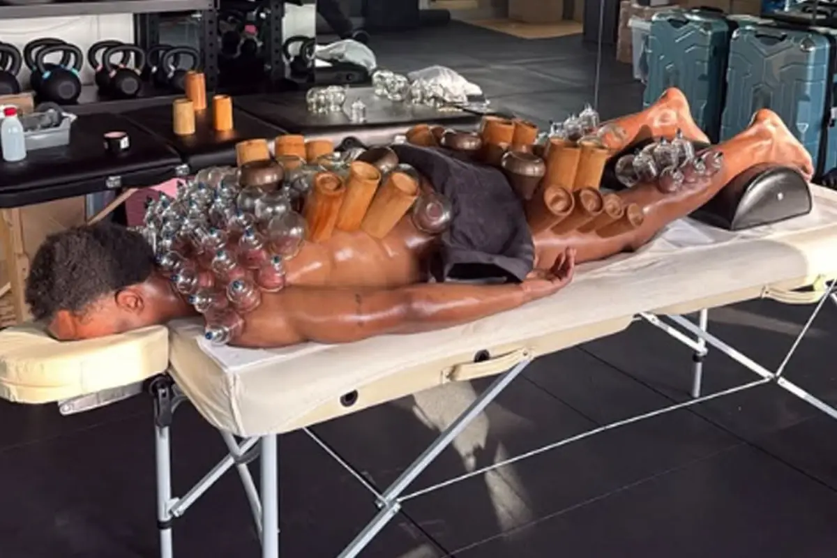 Leipzig Yıldızı Lois Openda’nın Hacamat Seansı Gözler Önünde