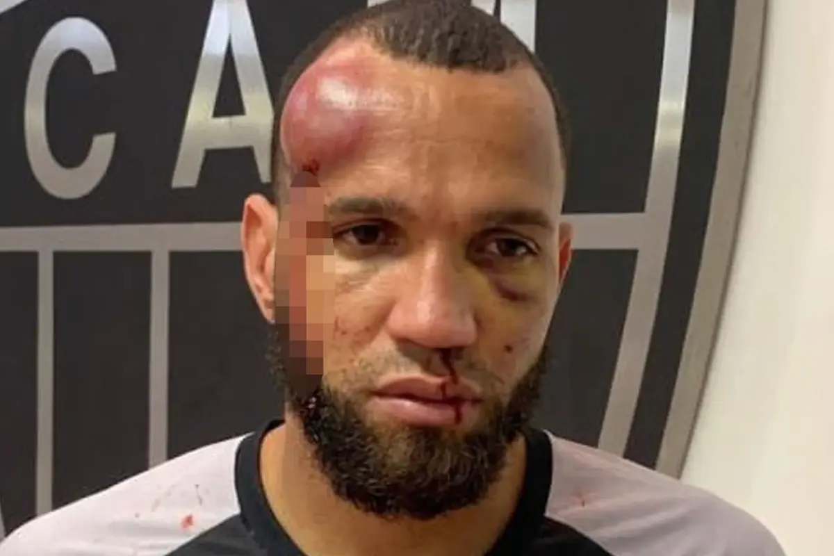 Cruzeiro-Atlético Mineiro Derbisi'nde 23 Kırmızı Kart ve Kaleci Morlukları