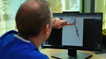 Diyabet ve Damar Tıkanıklığıyla Artan Kangren Riski: Uzman Uyarıyor