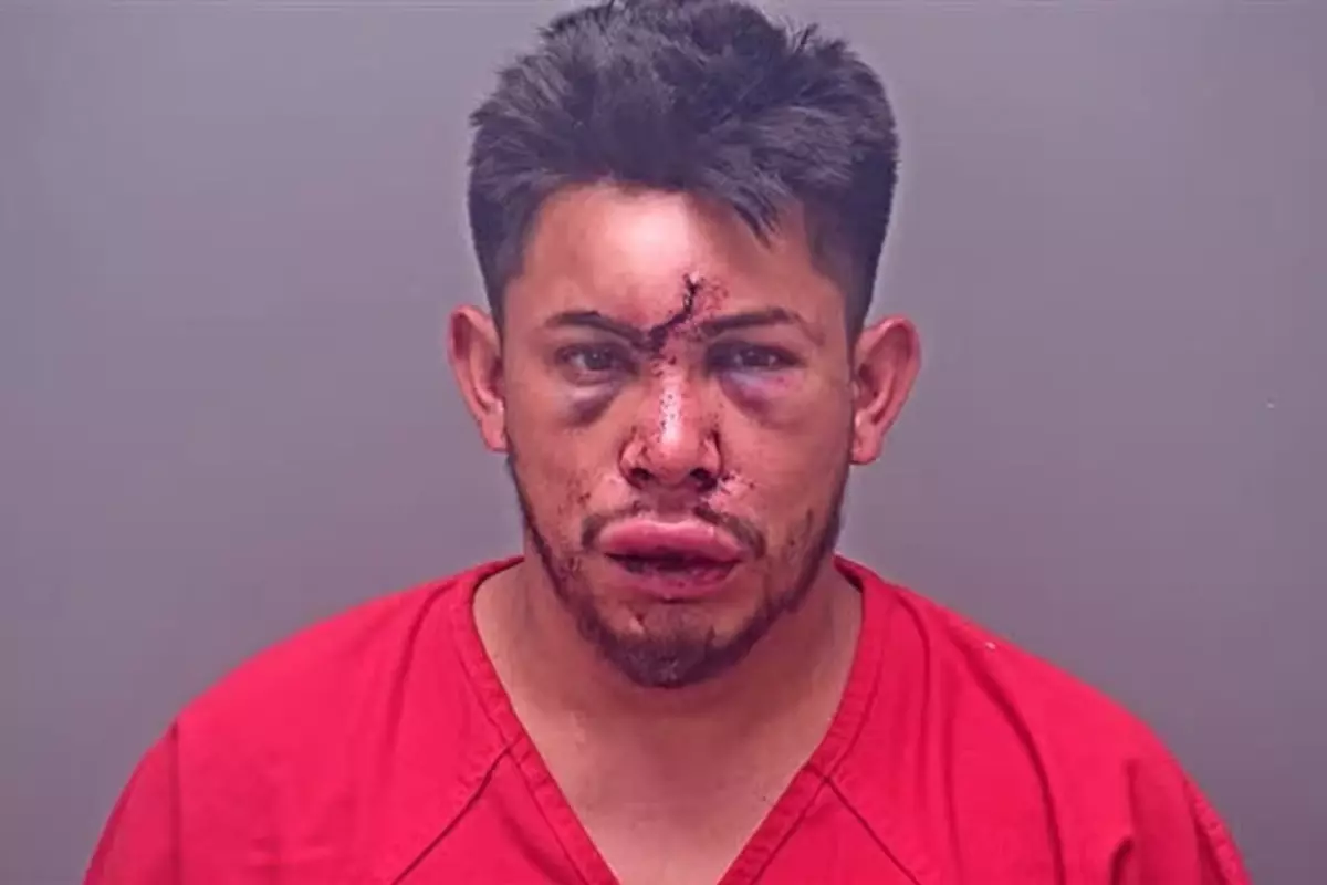 13 Yaşındaki Genç, Babasını Şiddet Saldırısından Korudu