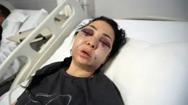 Saldırının anlık fotoğrafı
