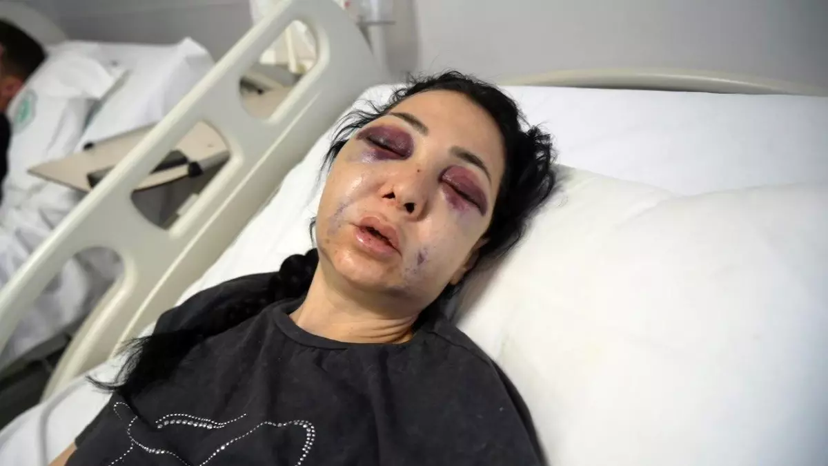 İzmit’te Bayram Günü Anne-Oğul Saldırısı: 1 Şüpheli Tutuklandı