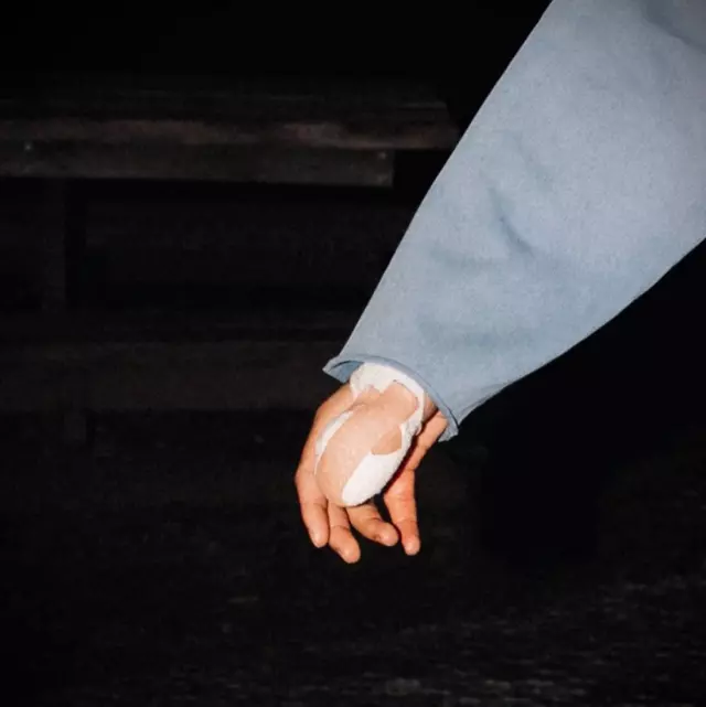 Noa Lang'in sargılı parmağı - Görsel 2