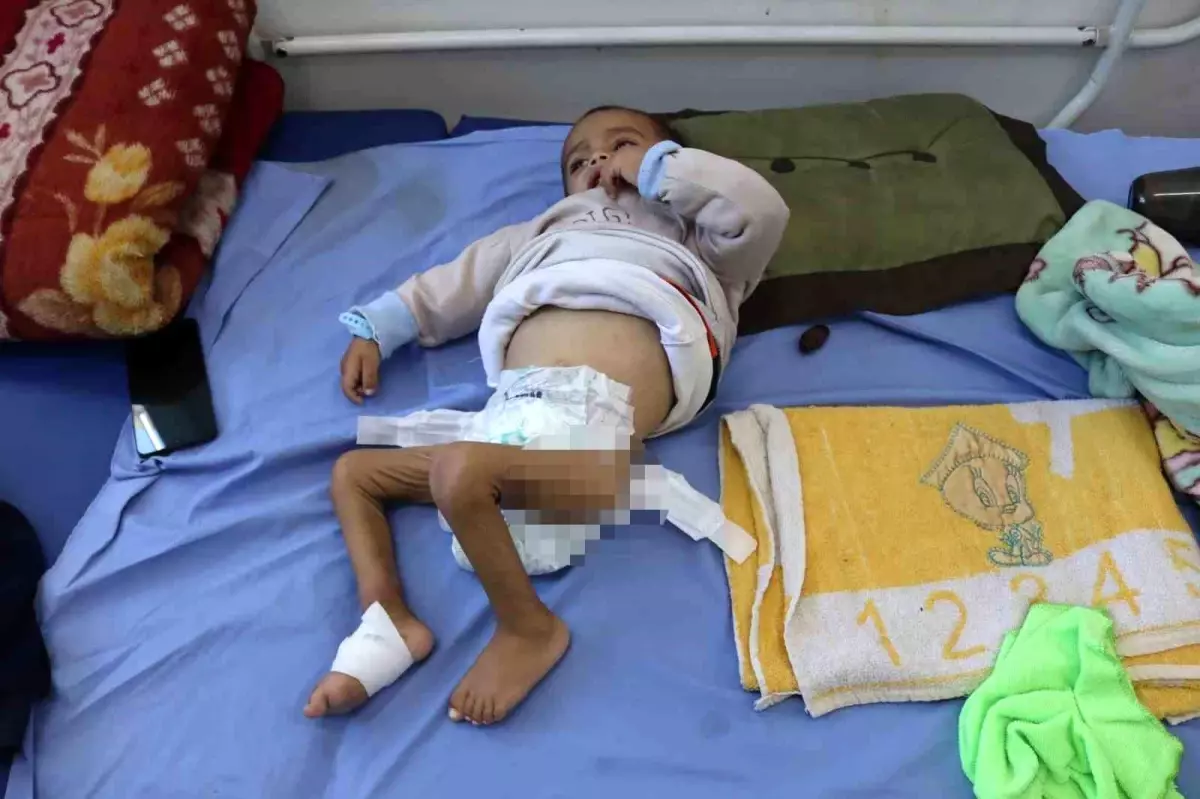 Gazze'de Çocuklar Açlıkla Mücadele Ederken Ekonomik Kriz Derinleşiyor