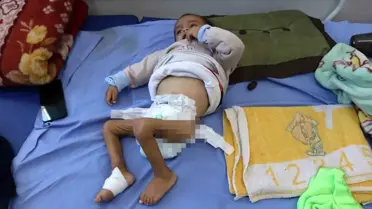 Gazze'de çocukların açlıkla mücadele ettiği görüntü