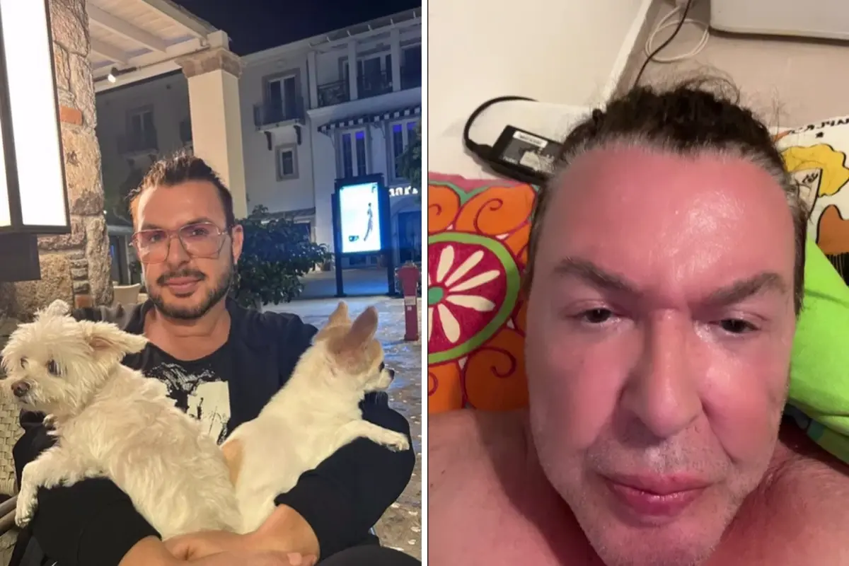 Kuşum Aydın'dan Yüz Germe Operasyonu Sonrası Şaşırtıcı Dönüşüm