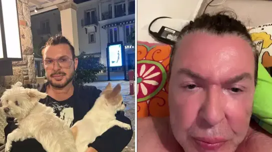 Kuşum Aydın'dan Yüz Germe Operasyonu Sonrası Şaşırtıcı Dönüşüm