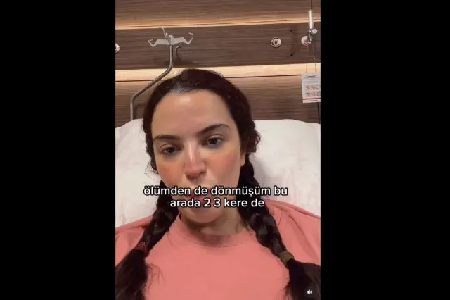 Ameliyat öncesi görüntü