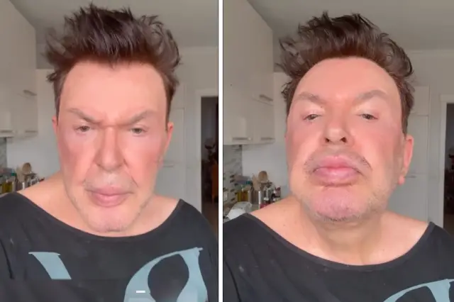 Kuşum Aydın estetik sonrası başka bir fotoğraf