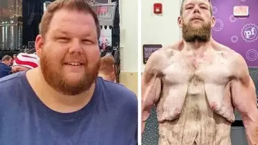 Cole Prochaska operasyon öncesi muayene