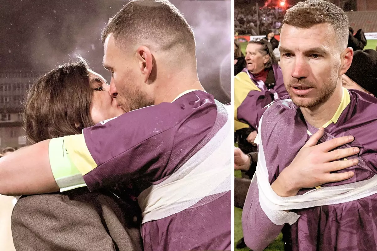 Edin Dzeko’nun Teknik Ekibi Üyesini Öpmesi 1 Nisan Şakasıyla Viral Oldu