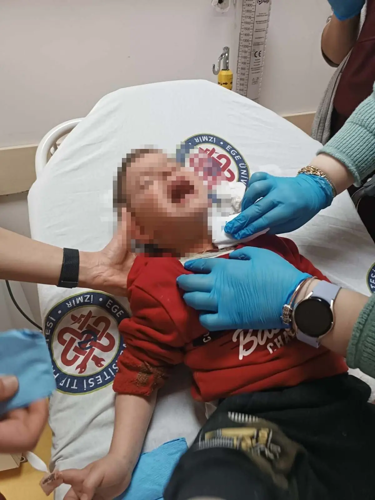 İzmir’de Parkta Gerçekleşen Bıçaklı Saldırıda 2 Yaşındaki Çocuk Yaralandı