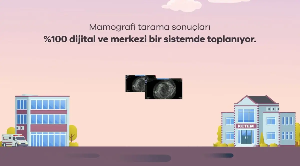 Yapay Zeka Destekli Mamografi Analizi: 2 Milyon Tarama Sonucu Sağlıkta Yeni Dönem