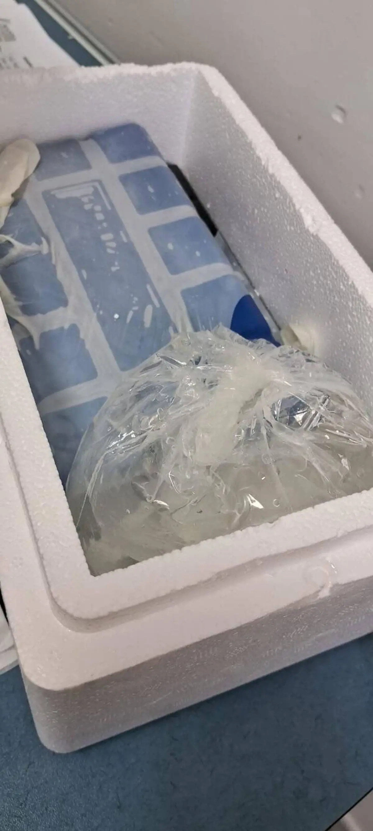 Manisa’da Sahipsiz Köpek Saldırısı: Sağ El Başparmağı Acı Bir Şekilde Koptu