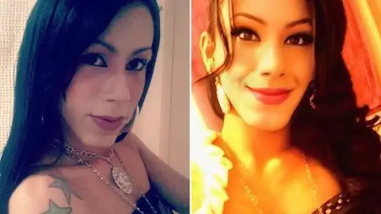 Brezilya’da Estetik Operasyon Kabusu: Yanlış Dolgu Sonrası Ağır Deformasyon