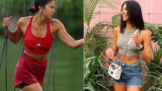 Survivor’un Gizem Memiç’i, Diz Ameliyatı Sonrası 2 Yıllık Mücadeleyi Anlattı