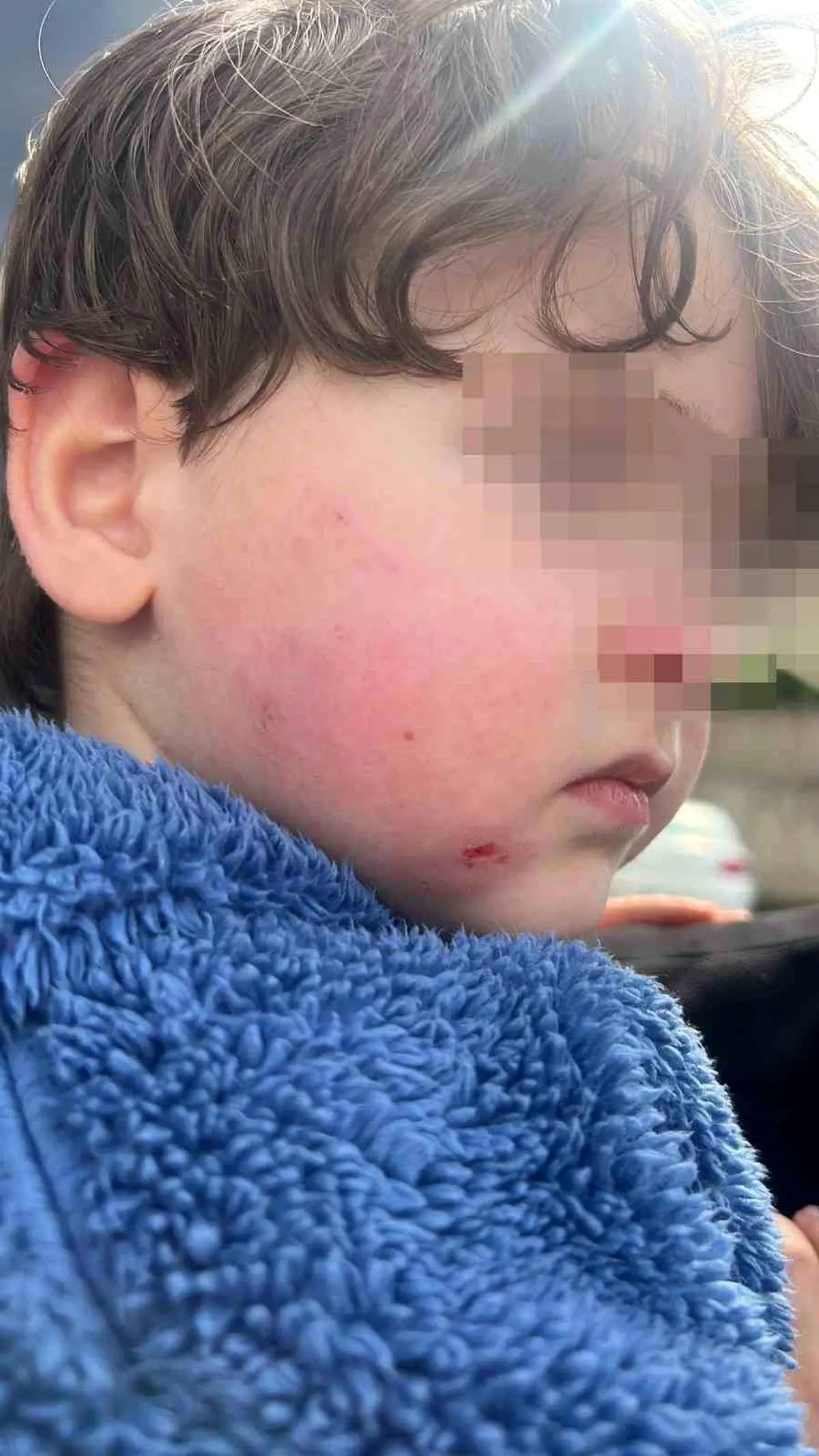 Gemlik'te Kreş Çocuğu Şiddet Olayı: Anne Şokta