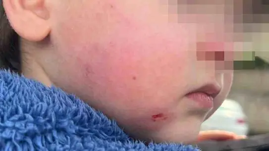 Gemlik'te Kreş Çocuğu Şiddet Olayı: Anne Şokta