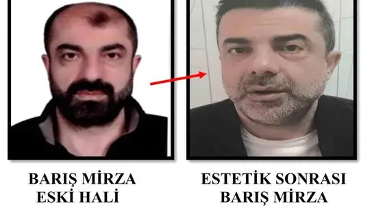 Yüz Değiştiren Cinayet Azmettiricisi Türkiye’ye Dönüş Yaptı