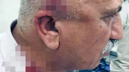 Kerkük’te Kaçak Yapı Yıkımı Sırasında Kaymakam Bıçaklı Saldırı