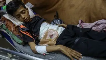 Gazze’de Savaşın Gölgesinde 13 Yaşındaki Çocuğun Hayat Mücadelesi