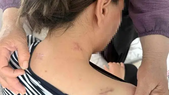 Mersin’de Kadına Şiddet Vakası: Havva Ç. 17 Bıçak Darbesiyle Hayata Tutundu