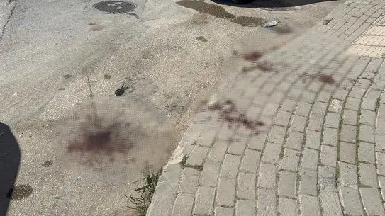 Bursa’da Sosyal Medya Fenomeni Kadını Bıçakla Yaraladı, Olay Canlı Yayına Yansıdı