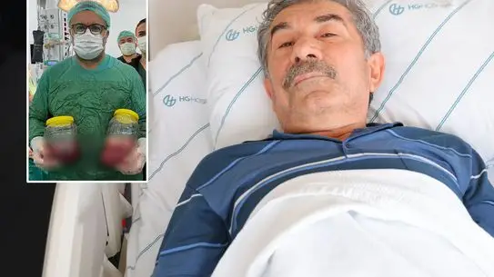 Kilo Kaybı Şikayeti Sonrası Böbrekte 20 cm'lik Tümör: Acil Ameliyatla Hayat Kurtarıldı