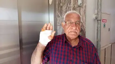 Ampute edilen serçe parmağın fotoğrafı