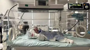 Mardin'de Nadir Doğuştan Hastalıkla Gelen Bebek Başarılı Ameliyattan Geçti