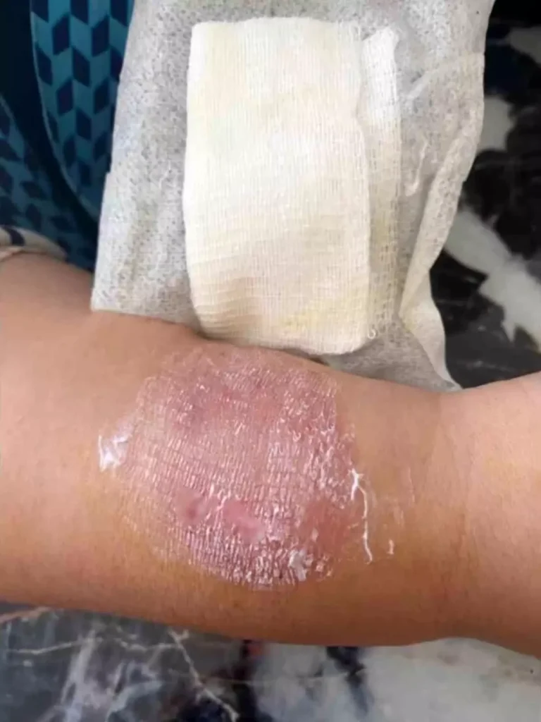 **Plajda Sigara Dumanı Kavgası**