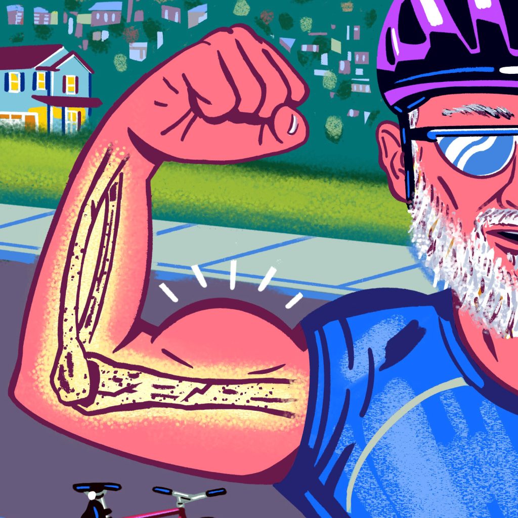 Why Brittle Bones Aren’t Just a Woman’s Problem