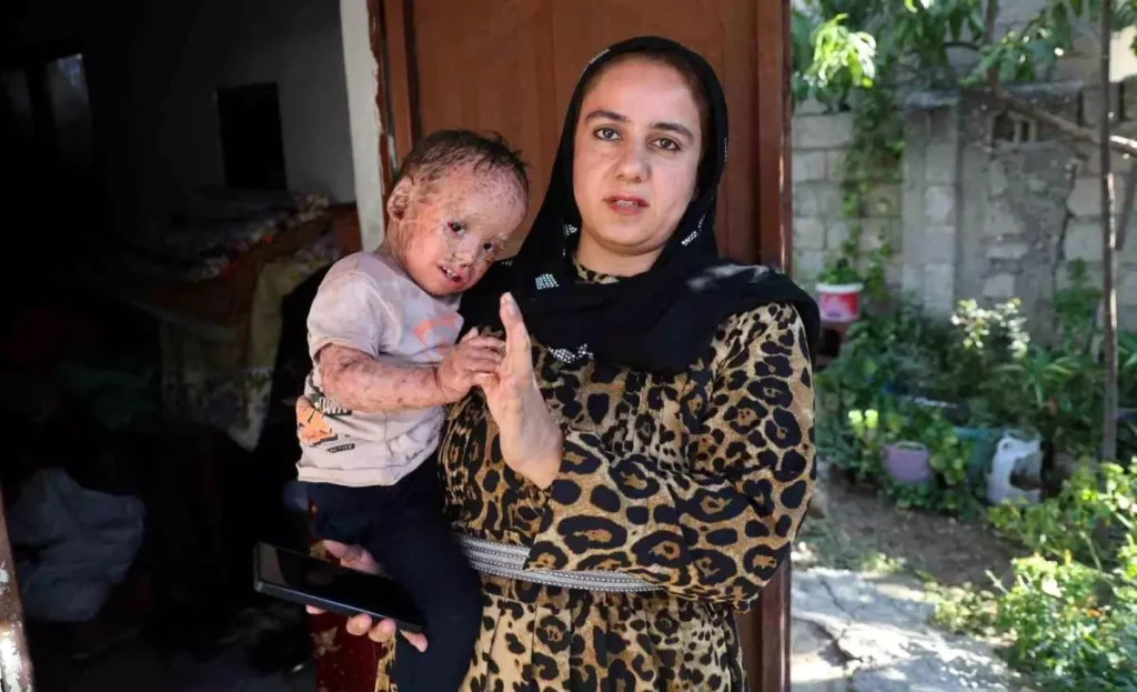 Dolandırıcılar 2 Yaşındaki Hastanın Fotoğraflarıyla Sahte Yardım Kampanyası Yürüttü