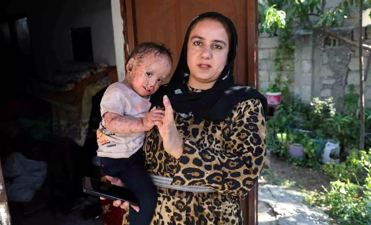 Dolandırıcılar 2 Yaşındaki Hastanın Fotoğraflarıyla Sahte Yardım Kampanyası Yürüttü