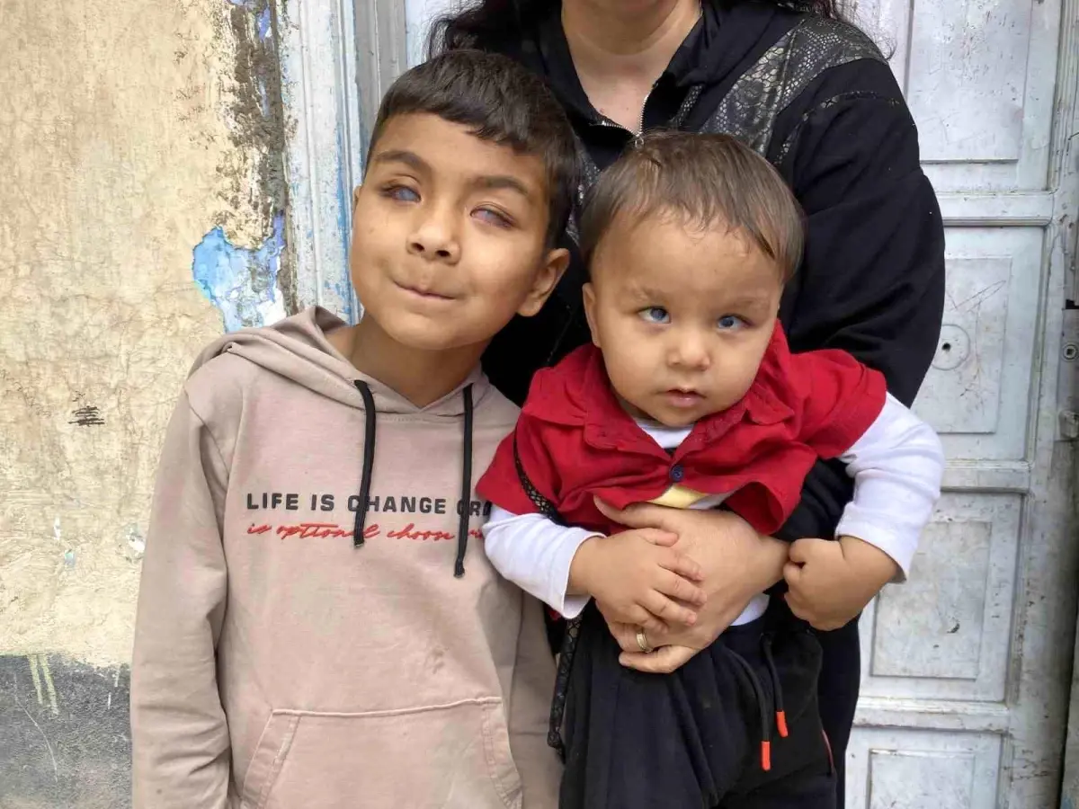 Eskişehir’de Tedaviyle Gözleri Açılan Kardeşler