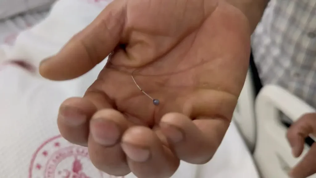 Genç Kızın Toplu İğne Trajediği: Hastanelerden Umut Kapısı