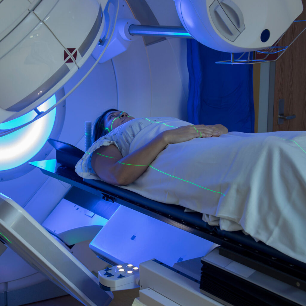 Radiation May Not Be Needed for a Growing Number of Breast‑Cancer Patients, Study Finds
