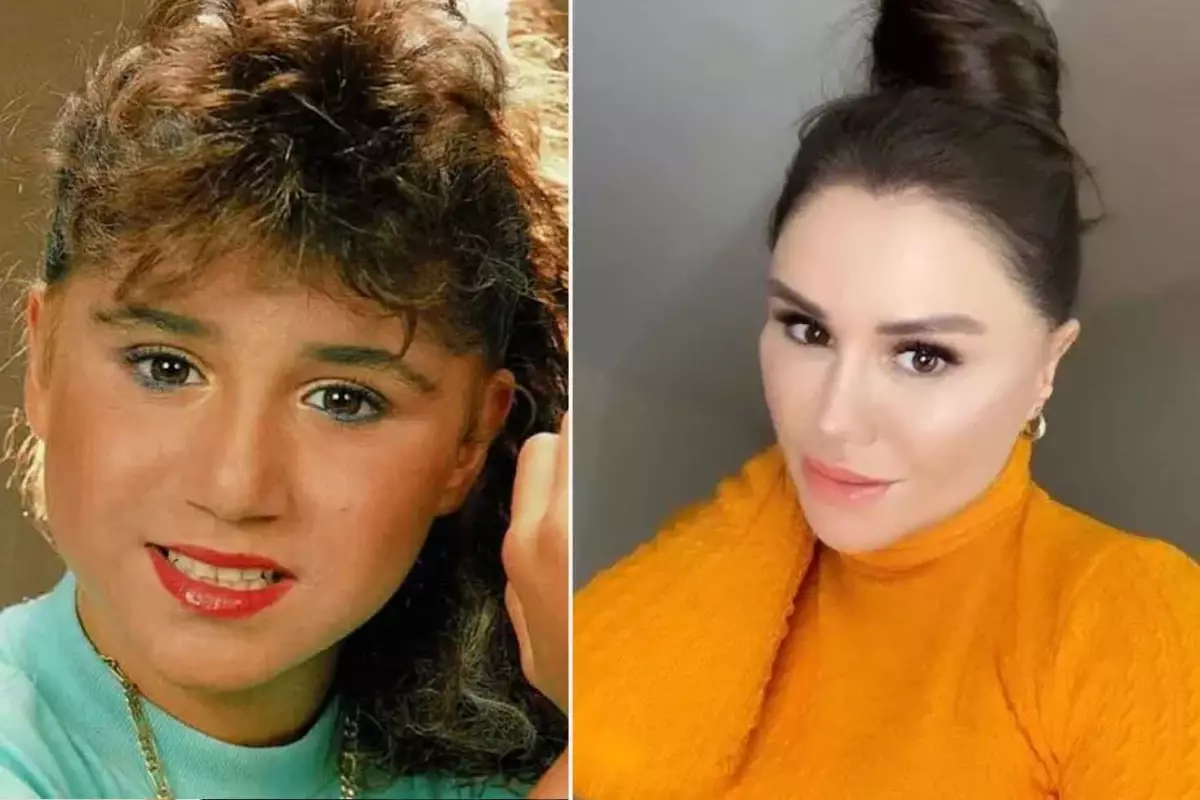 Ceylan’ın Son Hali Şaşırttı: Estetik Operasyonlarla Yeniden Doğdu!