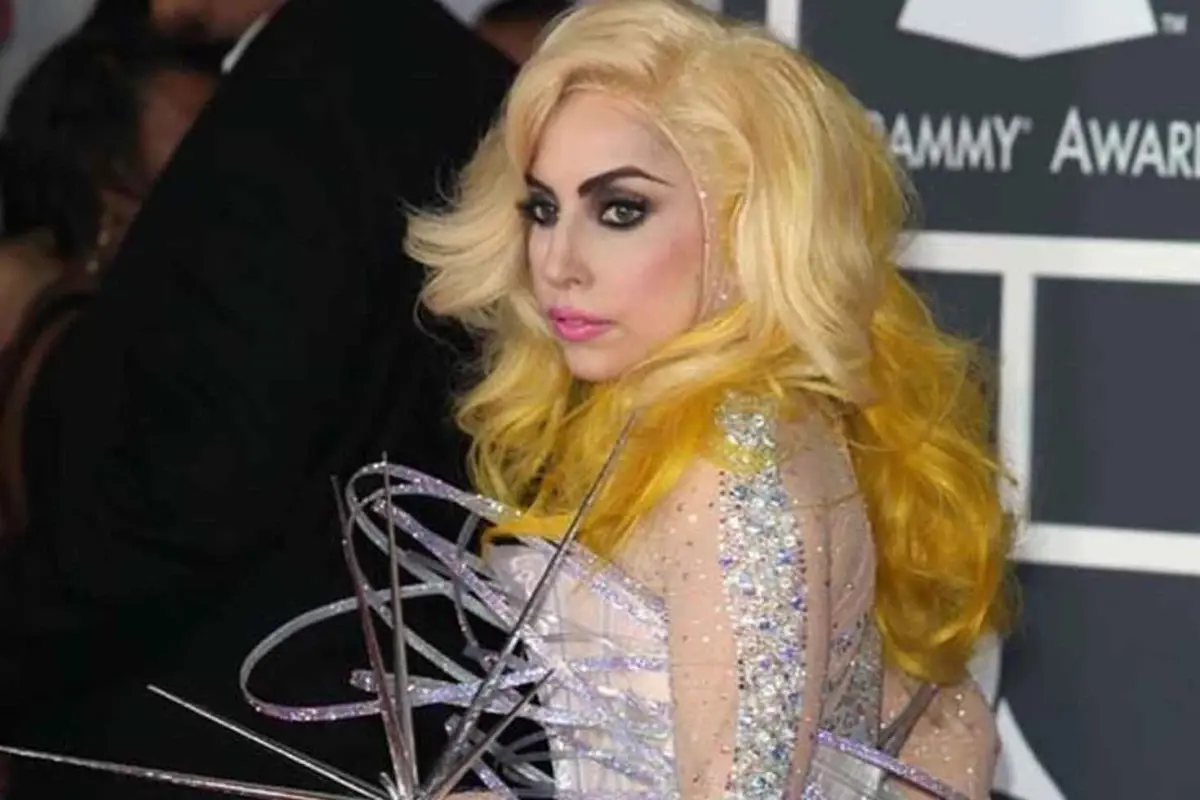 Lady Gaga’nın gizlediği sağlık sorununu açıkladı: Tamamen çökmüştüm