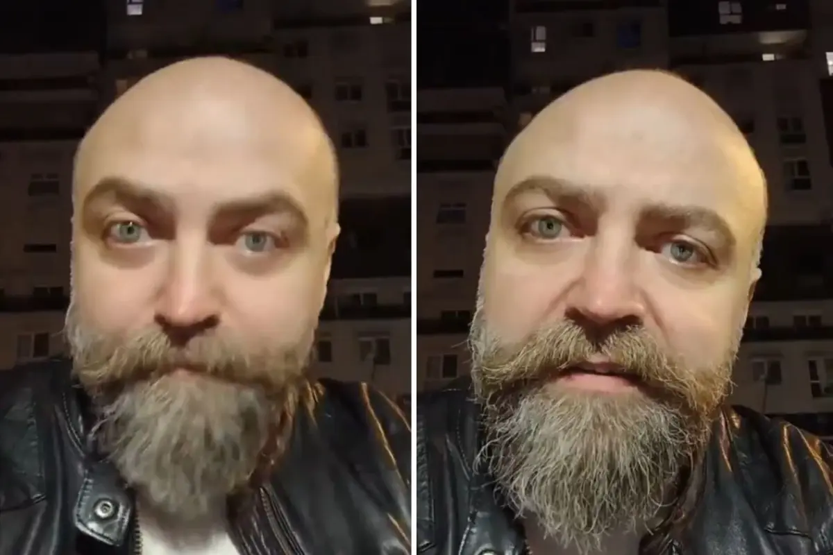 Saçsız adam isyan etti! Berbere ödediği ücret öyle böyle değil