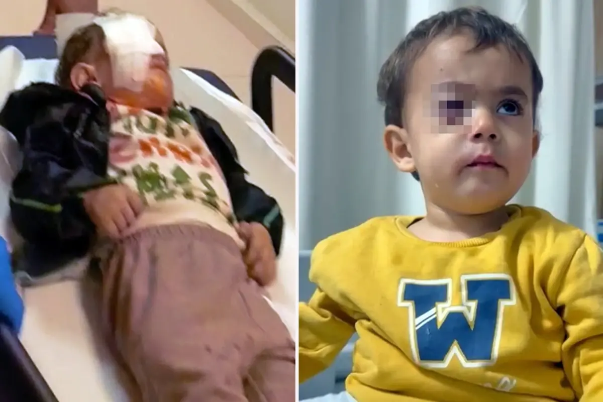 İnegöl’de Torpil Kazası: 2 Yaşındaki Çocuk Gözünü Kaybetti