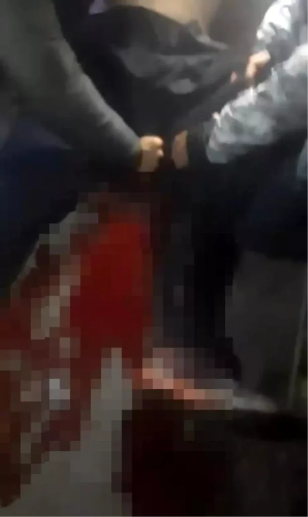 Üsküdar’da Yüksek Sesli Müzik Kavgası: Bir Yaralı