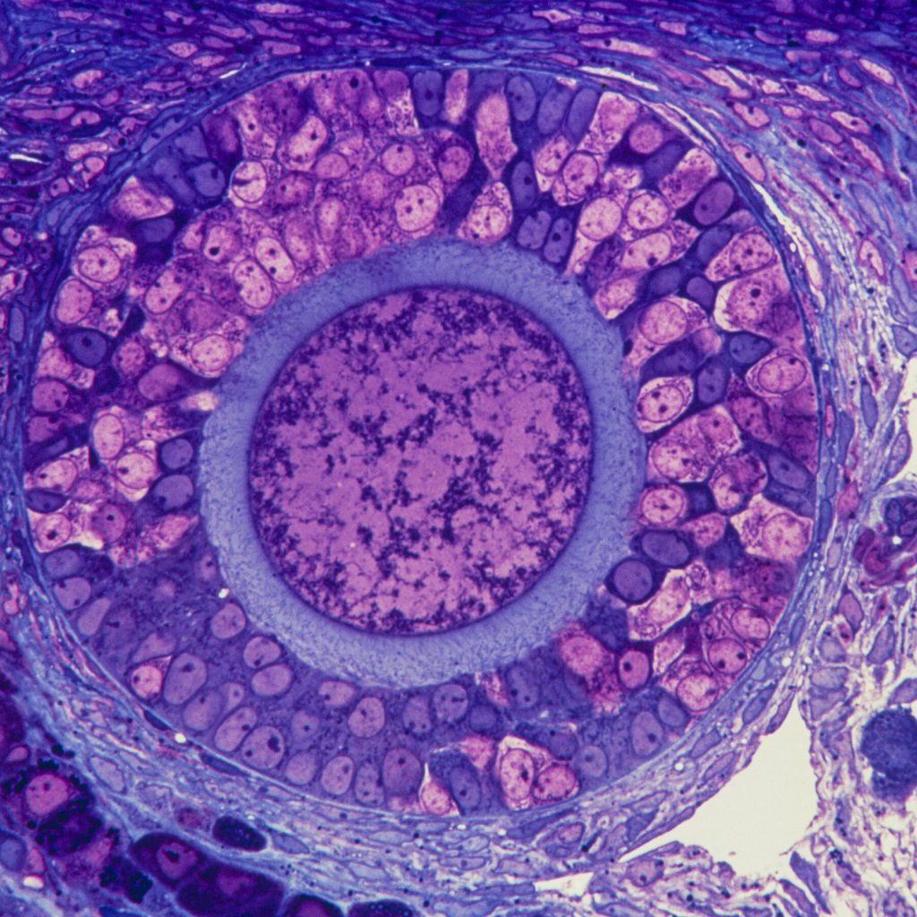 Doctors Think Ovaries, Not Just Eggs, Are Key to Fertility and Aging