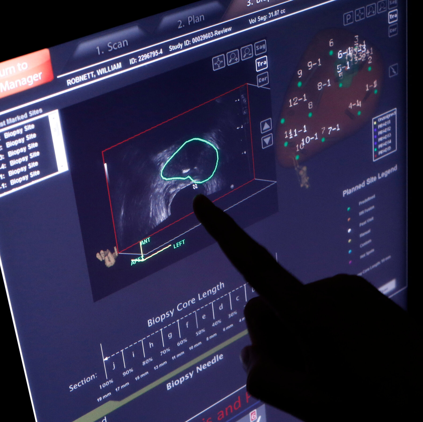 Why Some Doctors Argue That Certain Cancers May Not Require Treatment