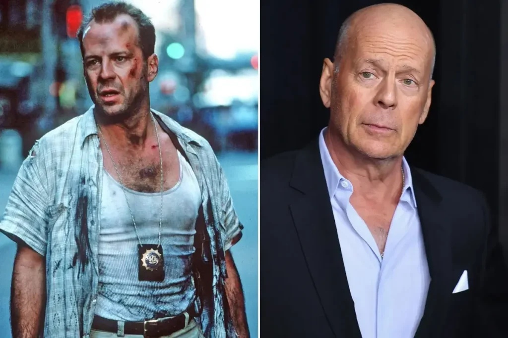 Ailesi Bruce Willis’in Beynini Bağışlama Kararı Aldı